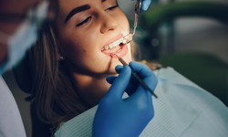 Understanding the Downsides: Disadvantages of Orthodontics