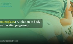 The power of abdominoplasty: Body restoration after pregnancy