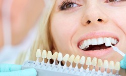 Teeth Whitening Treatment - Enhance your Overall Oral Health