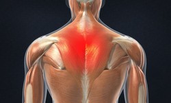 Have You Ever Faced Trapezius Muscle Pain?