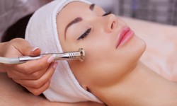 The Future of Acne Scar Treatment: Laser Innovations