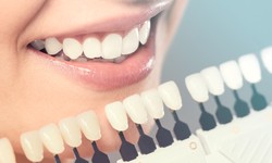 Dental Technology Services in McKinney, TX: Enhancing Your Oral Health