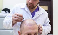 Rediscovering Your True Self with Hair Transplant Surgery