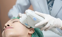 Ultherapy: The Non-Invasive Beauty Revolution