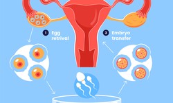 IVF is a Viable Option for Pakistani Couples