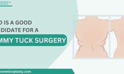 Who is a good candidate for a tummy tuck surgery?