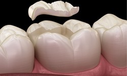 Dental Fillings for Broken Teeth: What Are Your Options?
