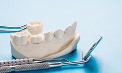 Dental Crowns in Lafayette, LA: A Comprehensive Guide to Restoring Your Smile