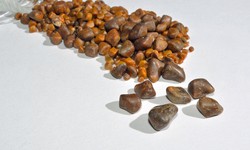 The Emotional Impact: Living with Gallstones and Kidney Stones