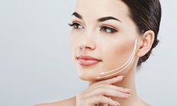 Why Buccal Fat Removal Is the Hottest Trend in Aesthetics ?