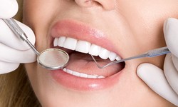 Dubai's Painless Dental Veneers: Exploring Comfortable Solutions