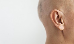 What Causes Ear Veins and How are They Treated