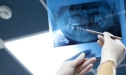 Understanding Tooth Fillings: Signs You Might Need One