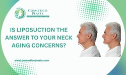 Is Liposuction the Answer to Your Neck Aging Concerns?