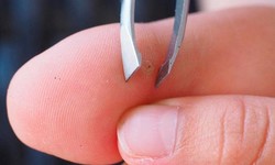 Painless Extraction: How to Get a Splinter Out with Ease