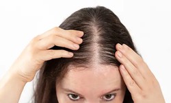 Why Is It Best To Choose A Customized Hair Loss Treatment In London?