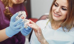 Discovering the World of Partial Dentures: A Comprehensive Exploration