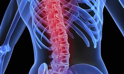 What is a Spinal Cord Injury and Its Causes?