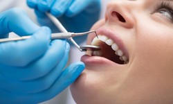 First Aid for Your Teeth: Emergency Dental Care at Home