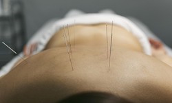 Acupuncture Treatment: How does acupuncture work?