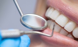 Dubai's Top Tips for Pain-Free Tooth Extraction