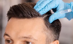 Who Is a Candidate for Female Hair Transplant?