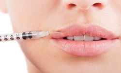 Enhancing Your Natural Beauty: Lip Augmentation in London