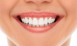Your Guide to a Confident Smile with Orthodontic Insights