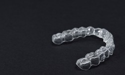 Unveiling the Success Rate of Invisalign: A Transparent Perspective