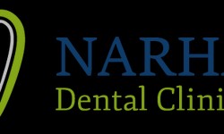 Guide to Root Canal Treatment at Narhare Dental Clinic, Wakad
