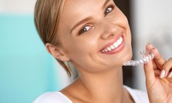 How Invisalign helps you with your eating habits