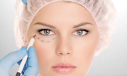 Blink of Brilliance: Navigating the World of Eyelid Surgery in Dubai