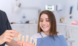 How Do Dental Implants Support Your Jaw's Structural Integrity?