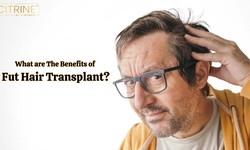 What Are The Benefits of FUT Hair Transplant?