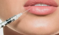 Beautiful Cosmetics MD: Transformative Cheekbone Injections in Chino