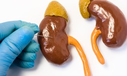 The Role of Kidney Biopsies in Diagnosing Kidney Diseases