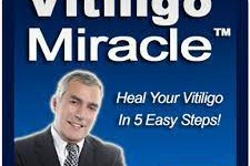 VITILIGO MIRACLE REVIEWS- ((WARNING!!)) - Vitiligo Miracle Review - Vitiligo Miracle Works?