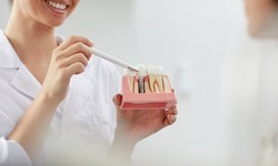 The Bright Side of Life: A Guide to Teeth Whitening Options