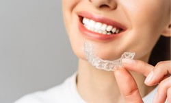 Straighten Your Teeth Discreetly: The Magic of Invisalign