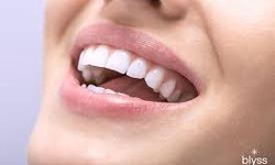 Teeth Whitening for Smokers: Strategies to Counteract Tobacco Stains