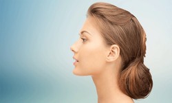 Sculpting Elegance: The Artistry of Chin Implants in Dubai