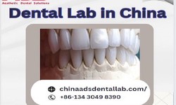 Enhance Your Dental Practice: Outsource Dental Lab in China with China ADS Dental Lab