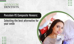 Porcelain vs Composite Veneers: Selecting the Best Option for Your Smile