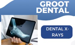 Dental X-Rays Services: A Vital Tool for Your Oral Health
