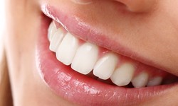 3 Popular Dental Treatments in Dubai for a Beautiful Smile