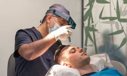 Unlocking the Secrets: Maximizing the Results of Your Hair Transplant in Dubai