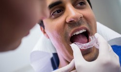 Finding Your Perfect Smile: Choosing the Right Invisalign Provider