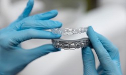 Revitalize Your Smile: Tooth Implants in Scottsdale Demystified