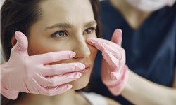 Nose Perfection in the Midlands: Non-Surgical Rhinoplasty Wonders