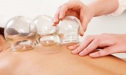 The Ultimate Guide to Hijama Therapy: Dubai's Answer to Holistic Health